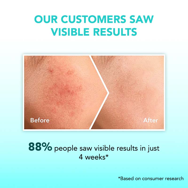 Anti-Pigmentation & Glow Kit