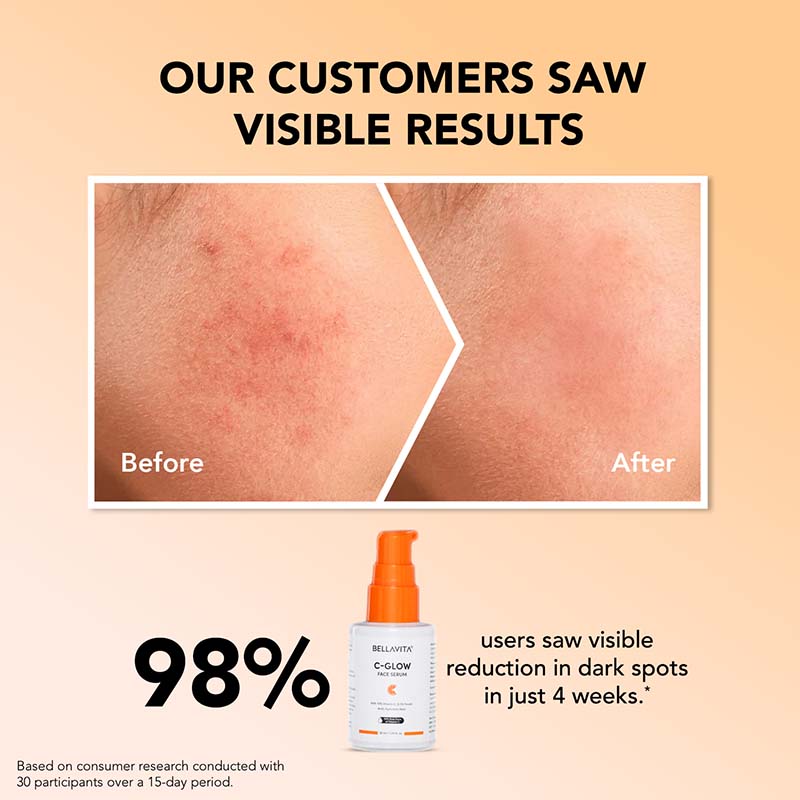 C-Glow 10% Vitamin C Serum - 30ml