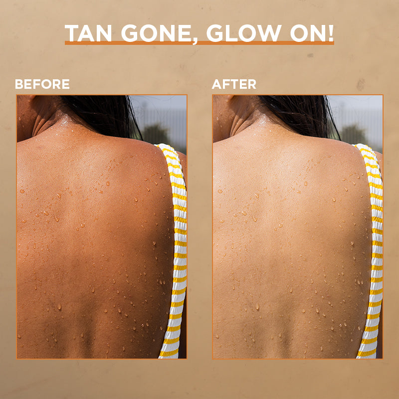 Detan Wonder Exfoliating Detan Soap