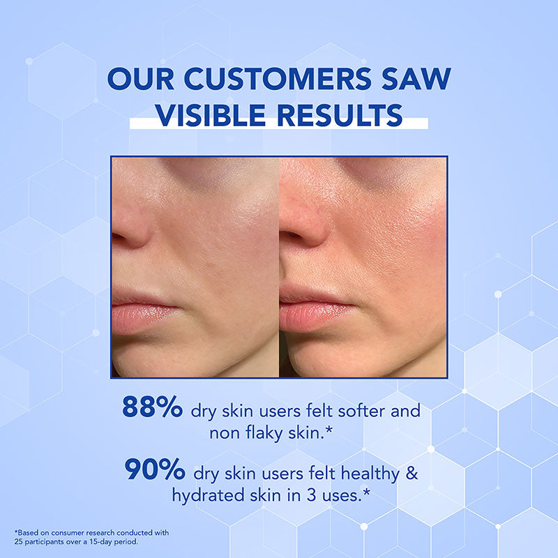 Dry Skin Moisturizer - 50ml