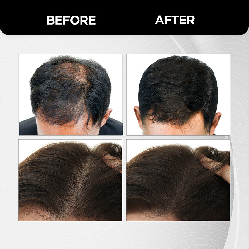 Hair Building Fibers - 12g