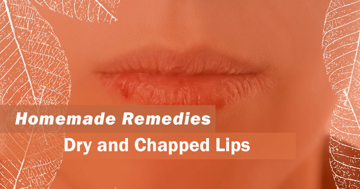 Homemade Remedies for Dry and Chapped Lips