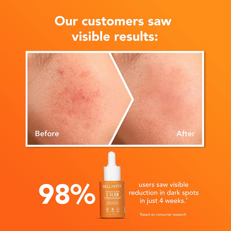 C-Glow 10% Vitamin C Serum - 30ml