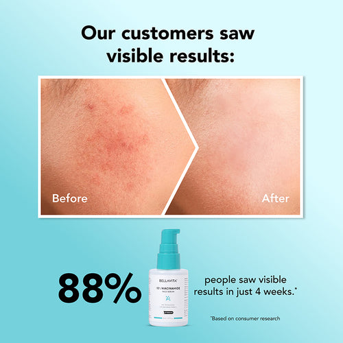 10% Niacinamide Face Serum - 30ml