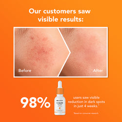 C-Glow 10% Vitamin C Serum - 10ml